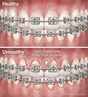 Oral-B Superfloss - Interdental cleaning - Mouth Ulcer & Gums – Mouth  Ulcers & Gums.