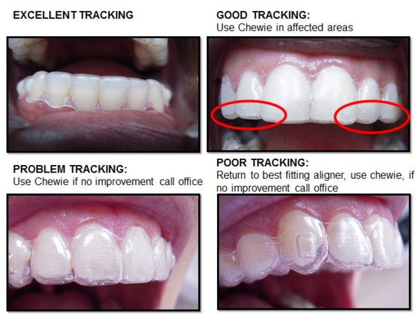 Invisalign Aligners Check Your Fit Morita Orthodontics