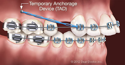 Morita Orthodontics