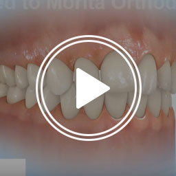 Morita Orthodontics